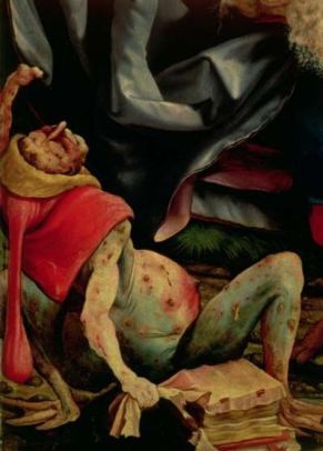 Suffering Man, detail from the reverse of the Isenheim Altarpiece, c.1510-15, Musee d'Unterlinden, Colmar, France / The Bridgeman Art Library 